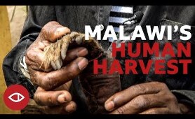 Malawi's Human Harvest - Full documentary - BBC Africa Eye